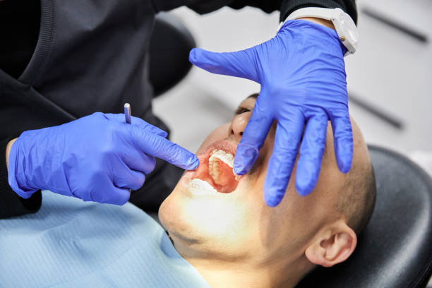 Best Broken Tooth Emergency  in Clear Lake, IA